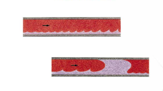 The formation process of water hammer